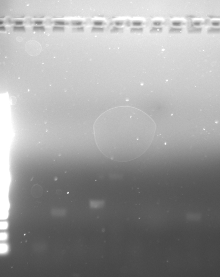 Gel electrophoresis results